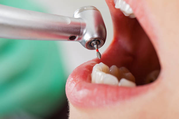 Best Emergency Dental Care for Broken or Chipped Teeth in Oakridge, OR